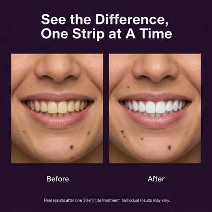 V34 Purple Whitening Strips