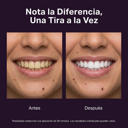 Tiras Moradas V34 para Dientes Más Blancos